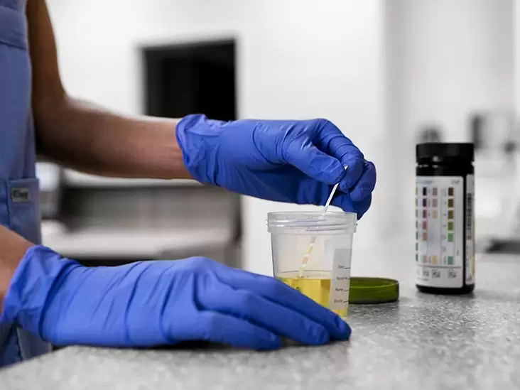  What is a 4 Panel Test?